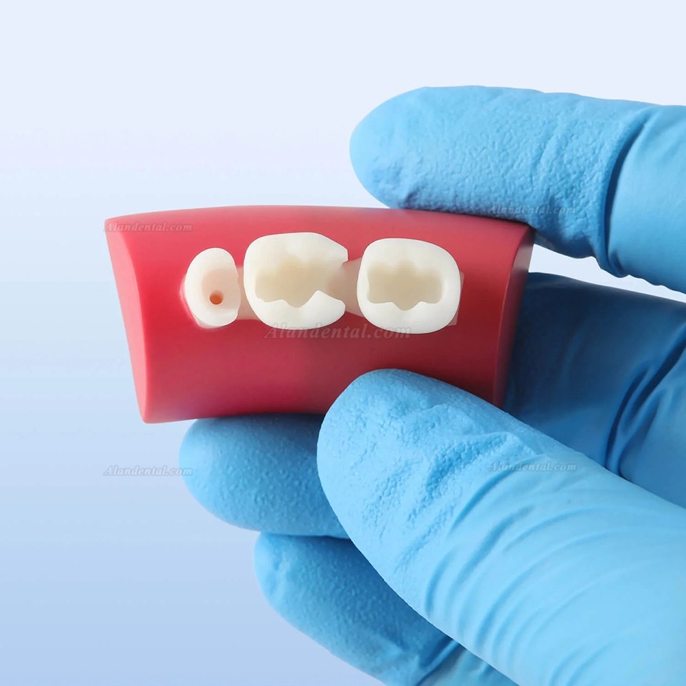 Dental Inlay Exercise Block Composite Resin Filling Teeth